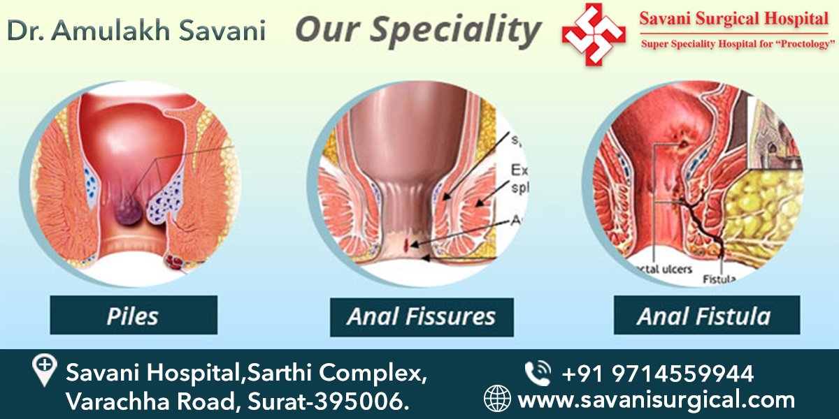 Our Speciality for Piles